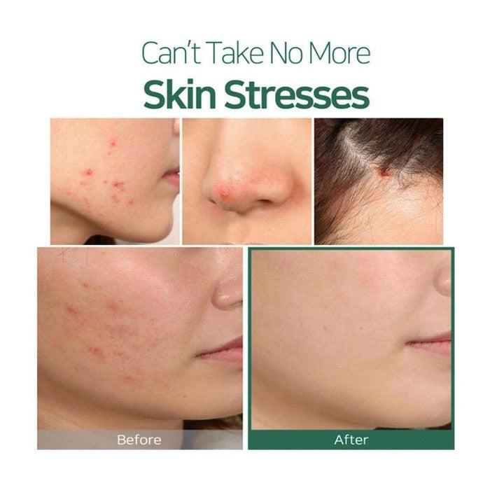 Packaging of SOME BY MI - 30 Days Miracle Tea Tree Clear Spot Oil