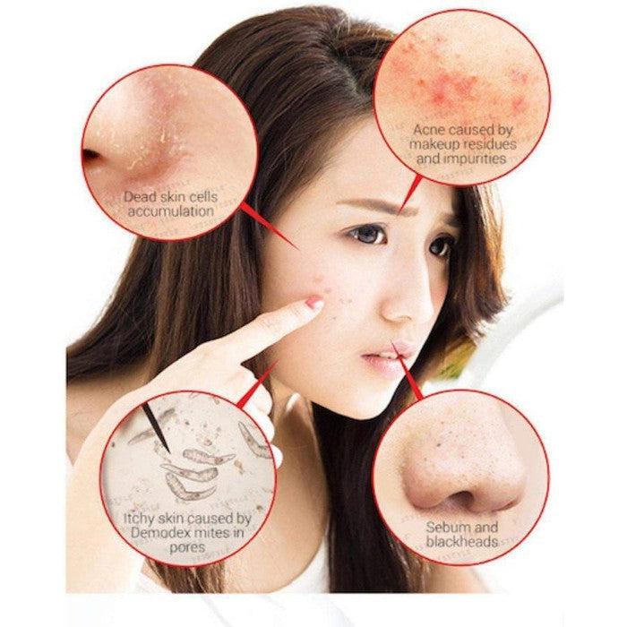 Packaging of SOME BY MI - AHA, BHA, PHA 30 Days Miracle Cleansing Ba