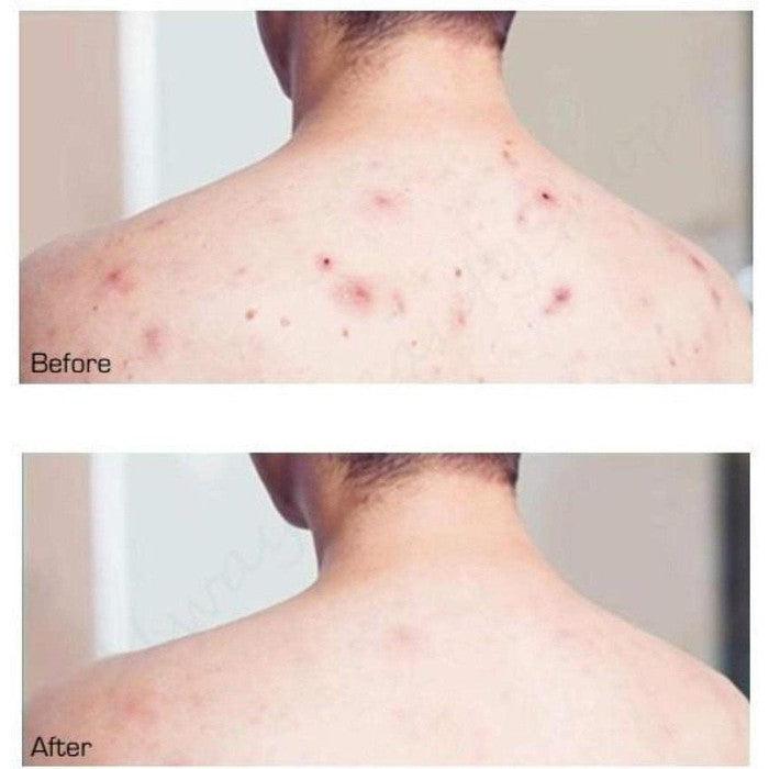 SOME BY MI - AHA, BHA, PHA 30 Days Miracle Cleansing Ba