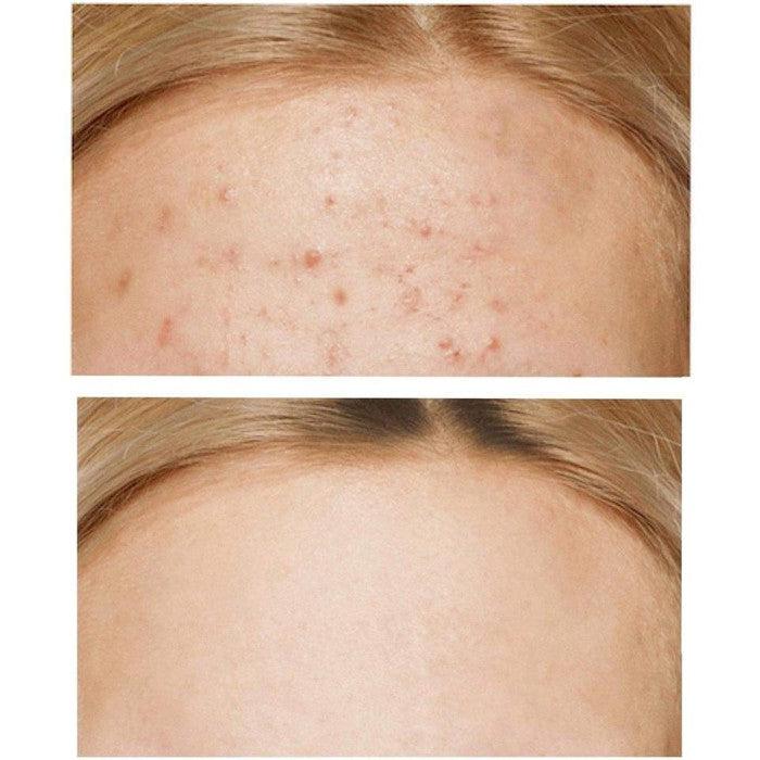 SOME BY MI - AHA, BHA, PHA 30 Days Miracle Cream