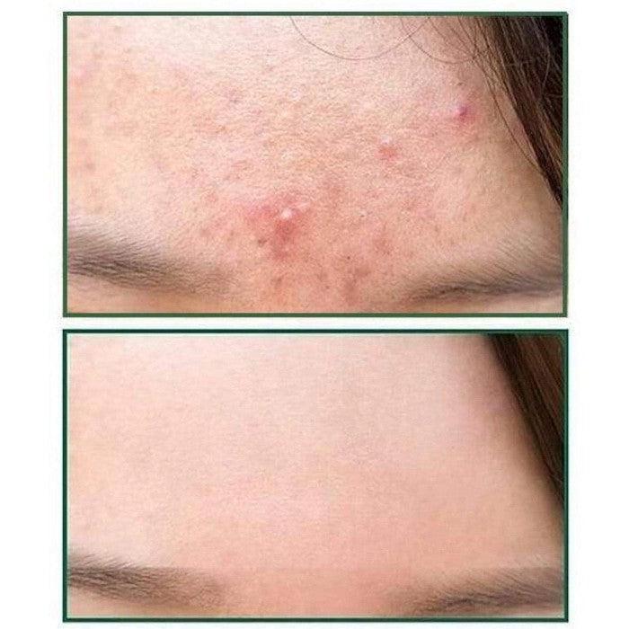 SOME BY MI Killing Cover Moisture Cushion SPF50+