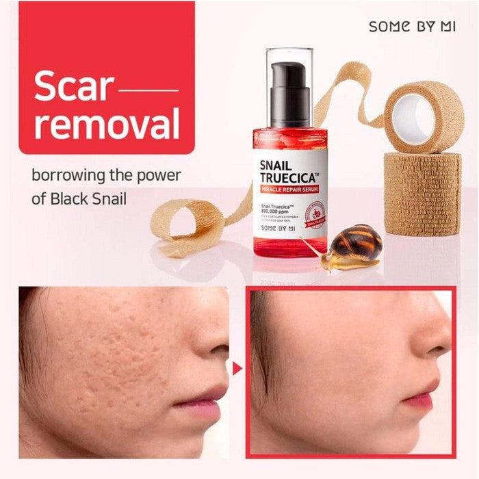 Packaging of SOME BY MI - Snail Truecica Miracle Repair Serum