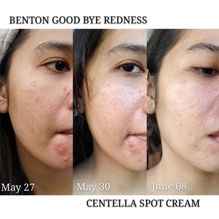 Benton Goodbye Redness Centella Spot Cream 15g